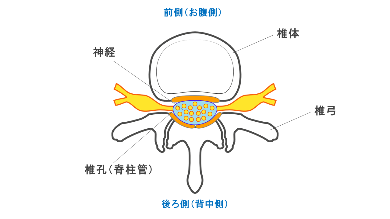 死活白在 椎骨療法 椎体置換を行わない低侵襲側方固定（LIF）を用いた骨粗鬆症性
